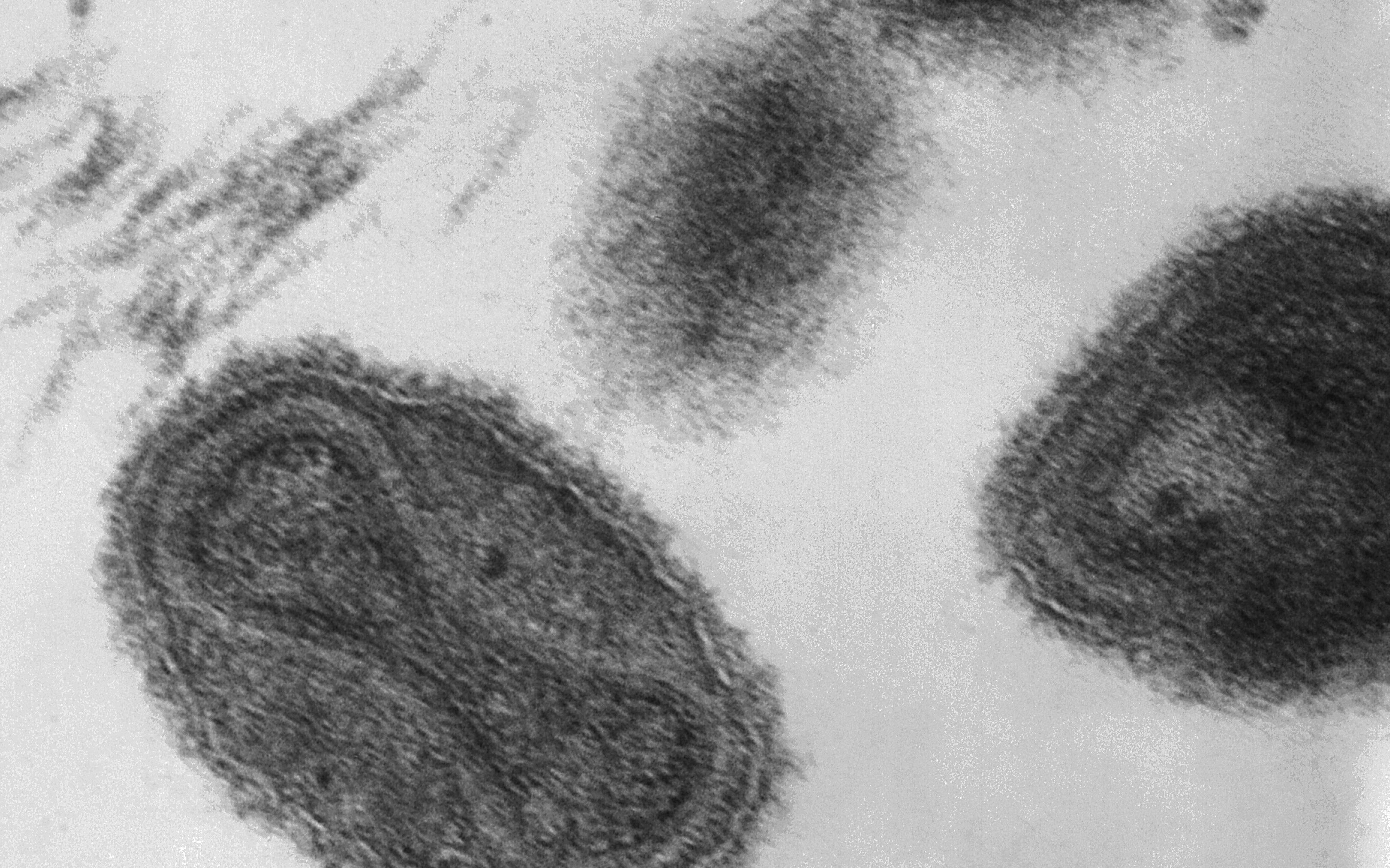 The smallpox virusunder a microscope. 
